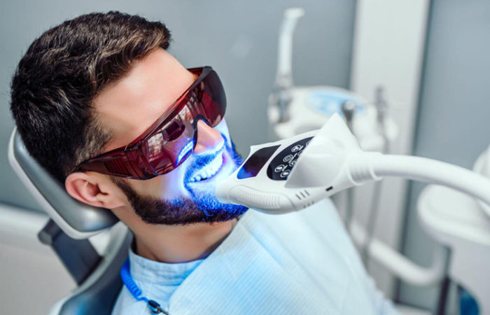 clareamento-dental-barueri-alphaville-ms-odontologia